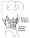 arnold press